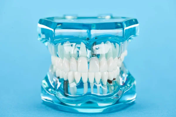 Foco seletivo do modelo de dentes com mandíbula saudável e dentes brancos em azul — Fotografia de Stock