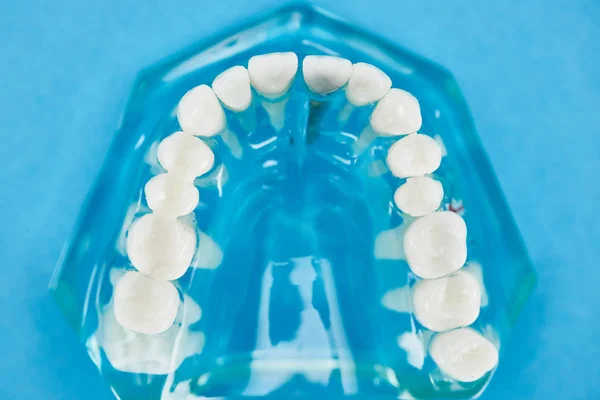 Enfoque selectivo del modelo de dientes con mandíbula saludable en azul - foto de stock