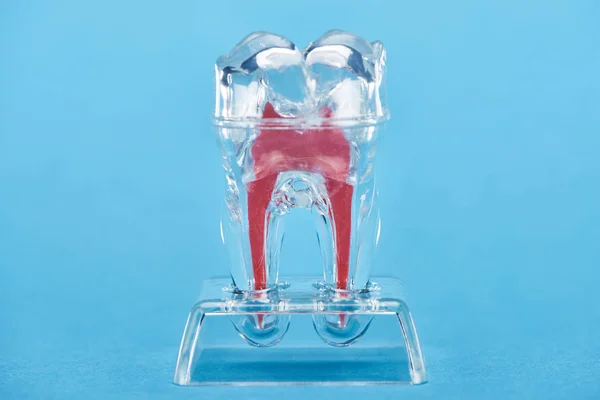 Modelo de diente de silicona con raíz dental roja aislada en azul - foto de stock
