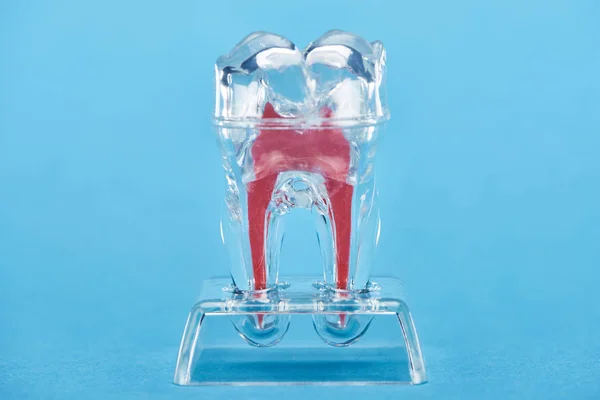 Silicone tooth model with red dental root isolated on blue — Stock Photo