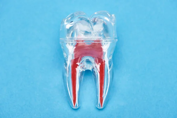Top view of silicone tooth model with red dental root isolated on blue — Stock Photo