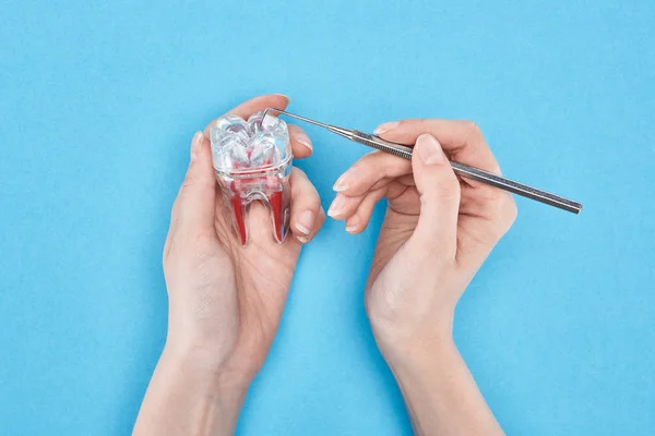 Vista ritagliata di donna che tiene strumento dentale vicino al modello di dente con radice dentale rossa isolata su blu — Foto stock