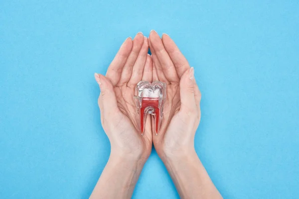 Vista cortada da mulher segurando modelo de dente com raiz dental vermelha isolada em azul — Fotografia de Stock