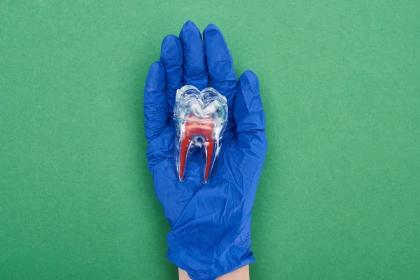 Vista recortada del dentista en guante de látex azul sosteniendo modelo de diente con raíz dental roja en verde - foto de stock