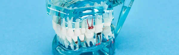 Panoramic shot of teeth model with red dental root in white teeth on blue — Stock Photo