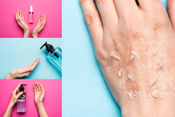 Collage de la main féminine avec peau déshydratée et exfoliée près de désinfectants sur bleu et rose — Photo de stock