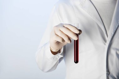 Doktor tüp kan ile tutarak görünümünü kırpılmış 