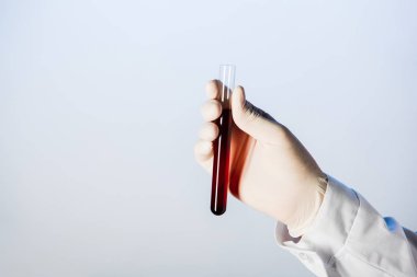 Doktor tıbbi eldiven tüp kan ile tutarak kısmi görünümünü 