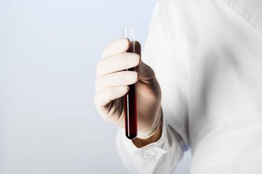 Medikal eldiven tüp kan ile tutan Doktor görünümünü kırpılmış 
