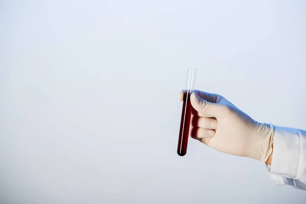 Vista Cortada Médico Segurando Tubo Teste Com Sangue Fundo Azul — Fotografia de Stock