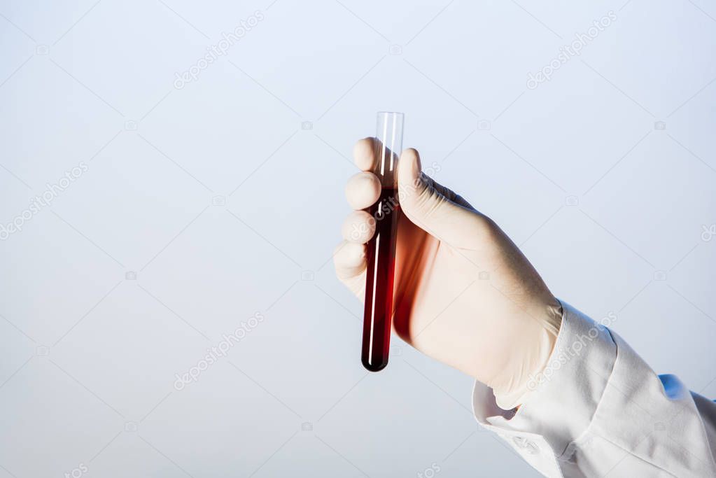 Partial view of doctor in medical glove holding test tube with blood 