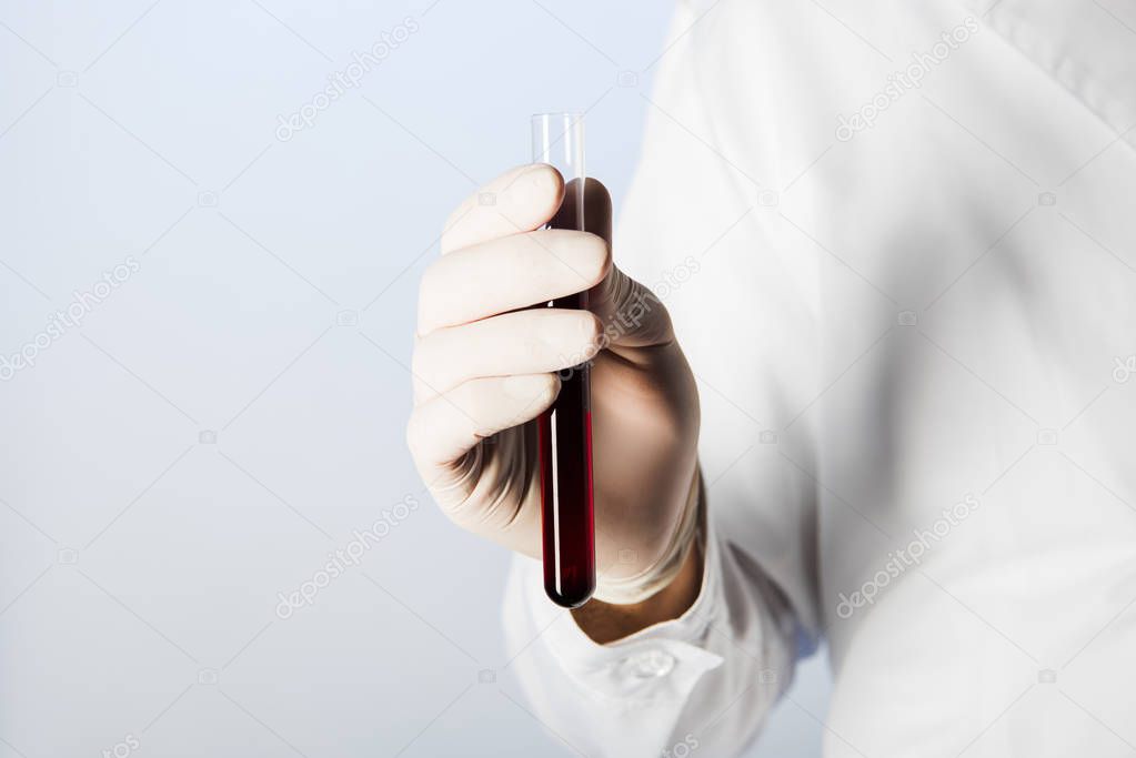 Cropped view of doctor in medical glove holding test tube with blood 