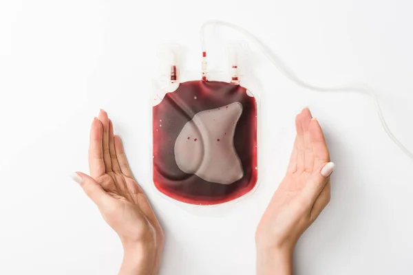 Vedere Decupată Femeii Care Deține Picurare Sânge Fundal Alb Conceptul — Fotografie, imagine de stoc