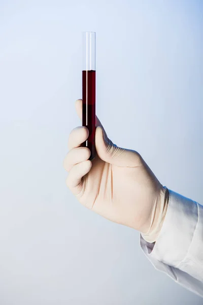 Partial view of doctor holding test tube with blood — Stock Photo