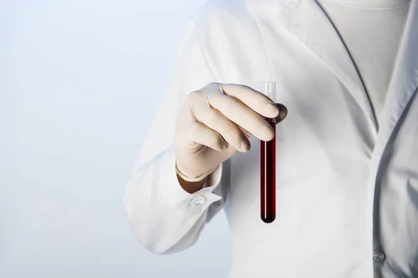 Vista recortada del médico sosteniendo el tubo de ensayo con sangre - foto de stock