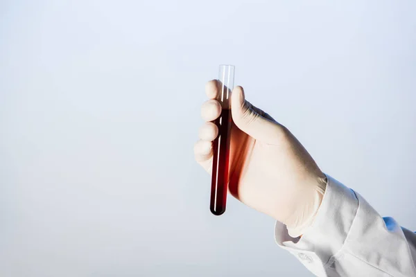 Partial view of doctor in medical glove holding test tube with blood — Stock Photo