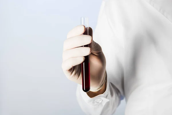Vue recadrée du médecin dans un gant médical tenant un tube à essai avec du sang — Photo de stock