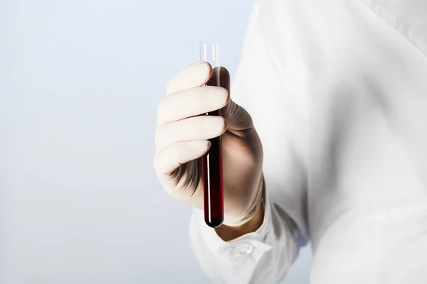 Cropped view of doctor in medical glove holding test tube with blood — Stock Photo