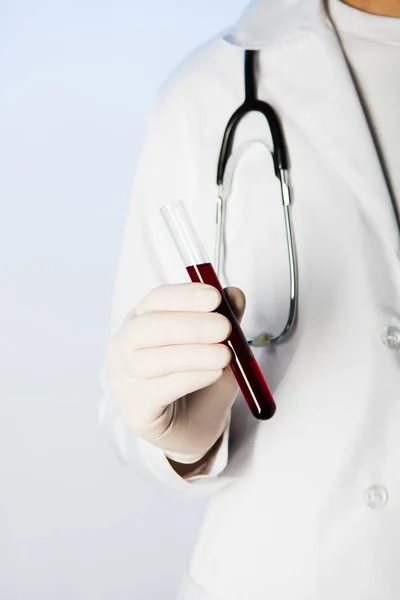 Vista recortada del médico con estetoscopio que sostiene el tubo de ensayo con sangre - foto de stock