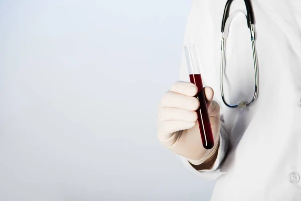 Частичное наблюдение врача со стетоскопом, держащего пробирку с кровью — стоковое фото