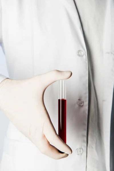 Cropped view of doctor in medical glove holding test tube with blood — Stock Photo