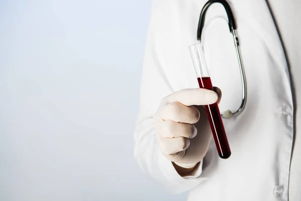 Vue partielle du médecin avec stéthoscope tenant une éprouvette avec du sang sur fond bleu — Photo de stock