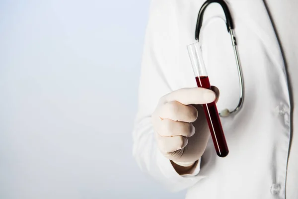 Partial view of doctor with stethoscope holding test tube with blood on blue background — Stock Photo