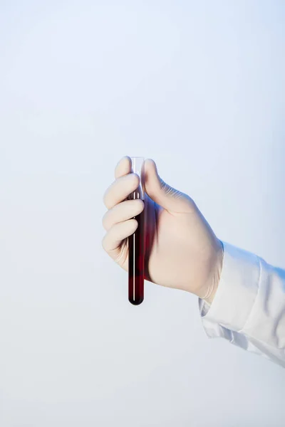 Vista parcial do médico segurando tubo de teste com sangue no fundo azul — Fotografia de Stock