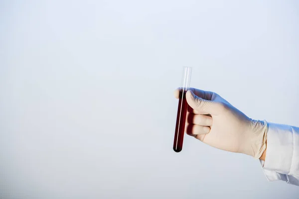 Cropped view of doctor holding test tube with blood on blue background — Stock Photo