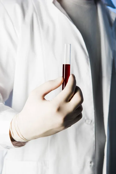 Vista recortada del médico en guante médico sosteniendo tubo de prueba con sangre - foto de stock