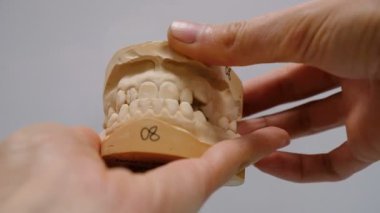 Köşeli ayraç sistemini yüklemeden önce diş alçı model. Jaws komik açık ve yakın bir doktor, bir kişinin çiğneme aparatı elinde