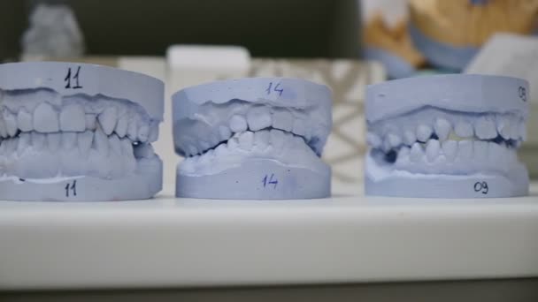 Гипсовые модели зубов стоят рядами на столе, движение камеры. Формы в кабинете стоматолога, гипсовые челюсти — стоковое видео