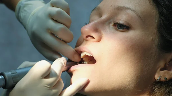 Dentista mói e limpa os dentes antes de instalar o sistema de suporte close-up. Visita ao dentista — Fotografia de Stock
