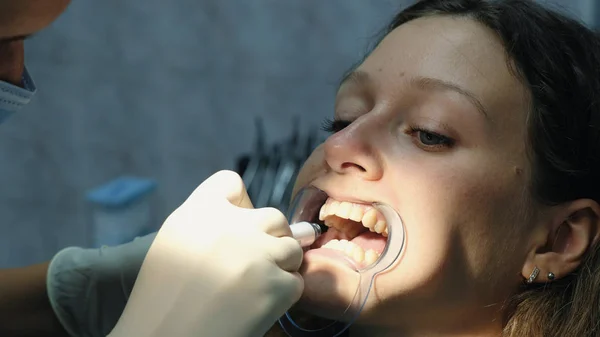 Dentista lubrifica os dentes no retentor antes de instalar o sistema de suporte. Visita ao estomatologista ortodontista — Fotografia de Stock