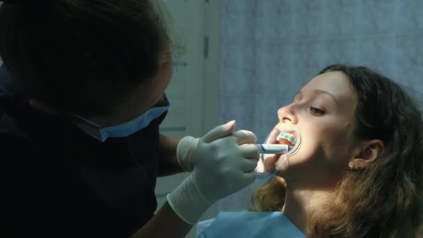 Orthodontist geldt de gel op de tanden alvorens het beugel-systeem te installeren. Bezoek aan de tandarts — Stockvideo