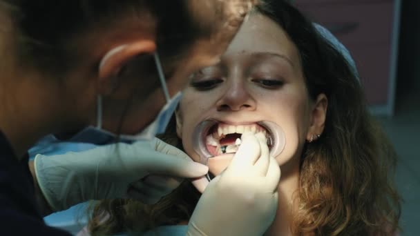 Dentista coloca a lã de algodão na boca do paciente antes de instalar o sistema de suporte close-up. Visita ao ortodontista — Vídeo de Stock