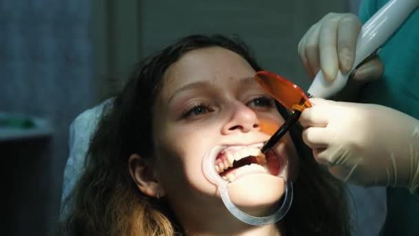 El asistente del dentista brilla con una lámpara ultravioleta de polimerización dental en el primer plano de los dientes de los pacientes. Visita al estomatólogo — Vídeo de stock