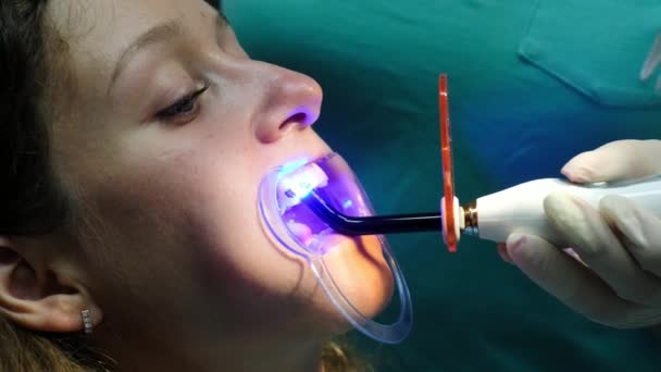Visita ao dentista, instalação do sistema de suporte. Estomatologista brilha com uma lâmpada UV de polimerização dental no aparelho para o paciente close-up . — Vídeo de Stock