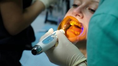Diş hekimine, köşeli ayraç sisteminin kurulumu ziyaret edin. Diş bir ultraviyole lamba ile Yardımcısı parlar, ortodontist dirsek diş yakın çekim ayarlar.