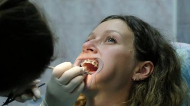 Dişçiye ziyaret edin. Bir doktor ortodontist demir diş telleri ile bir diş fiksatör ve inşaat ile ağız yakın çekim araçlarında bir kadınla yükler.