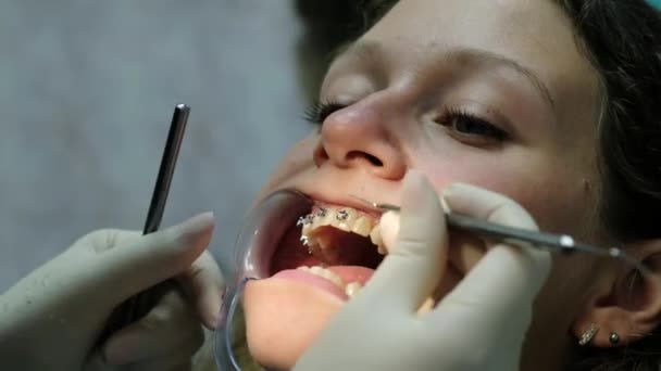 ブラケット システムのインストールと、不正咬合の矯正歯科医に訪問します。矯正修正確立されたブラケット クローズ アップ. — ストック動画