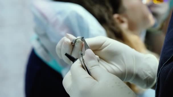 Installation of metal braces close-up. Orthodontist applies glue to the bracket — Stock Video