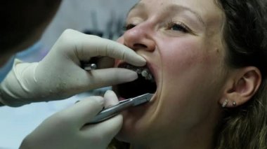 Diş hekimine, köşeli ayraç sisteminin kurulumu ziyaret edin. Ortodontist metal bir ortodontik kemer ayraçlar içinde kurar.