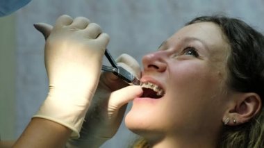 Diş hekimine, diş telleri kurulumu. Ortodontist diş telleri üzerinde forseps ile ortodontik yay gerginlik düzeltir.