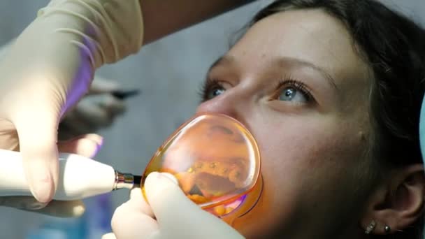 Bezoek aan de tandarts, de installatie van het systeem van de beugel, de correctie van de malocclusie. Assistent schijnt met een tandheelkundige polymerisatie UV-lamp aan fixatie de haakjes close-up. — Stockvideo