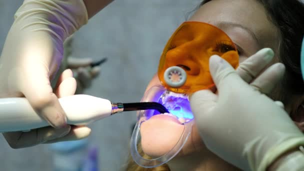 Assistente brilha com uma lâmpada ultravioleta de polimerização dental para fixação os suportes de close-up. Visita ao dentista, instalação do sistema de suporte — Vídeo de Stock