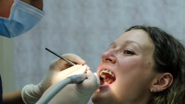 Bezoek aan de tandarts. Orthodontist boren en corrigeert het patch-zegel na het installeren van het systeem van de beugel — Stockvideo