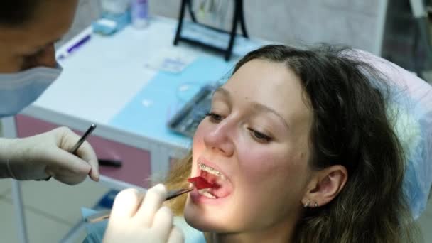 Bezoek aan de tandarts. Orthodontist corrigeert beet met calqueerpapier en afdichtingen — Stockvideo