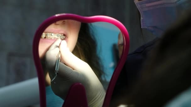 Visite et consultation du dentiste, installation d'appareils. L'orthodontiste raconte le plan de traitement, le patient regarde dans le miroir les appareils — Video