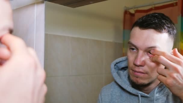 Un joven se pone lentes de contacto en el baño frente a un espejo, 4k — Vídeo de stock